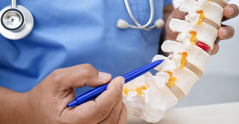 Endoscopic Spine Surgery